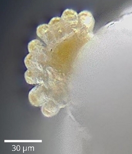 Silba adipata McAlpine larva: anterior spiracle.