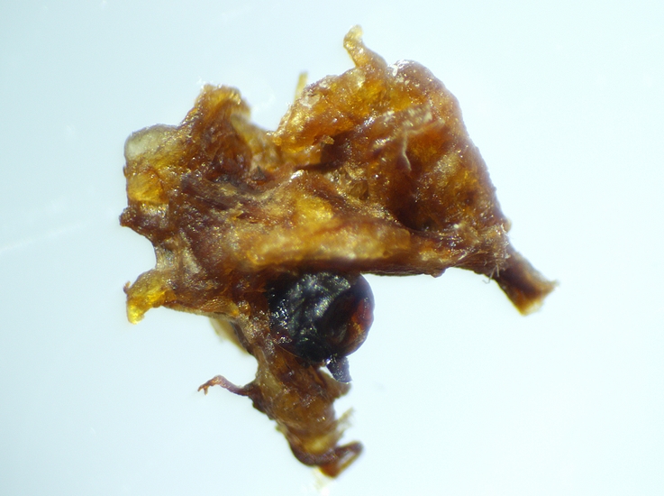 Examination under a stereomicroscope of a brownish mass with a blackish ball, extracted from the infructescence of the D2 fig.