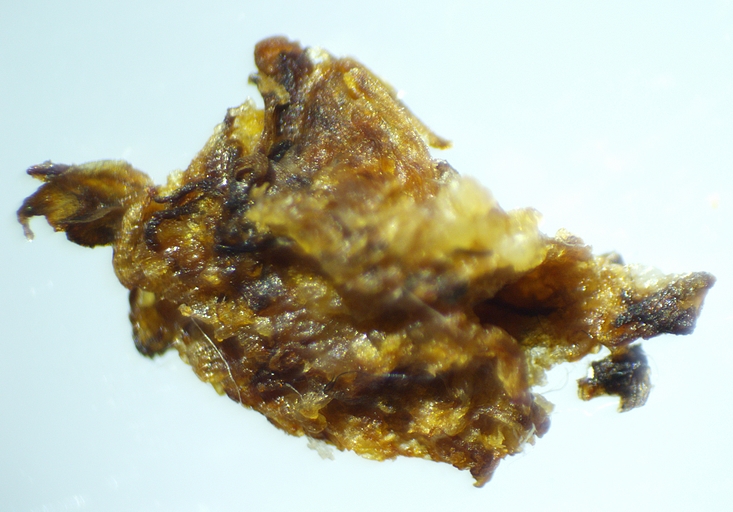 Brownish mass with blackish components, of hard consistency, extracted from the soft infructescence of the D4 ripe fig.