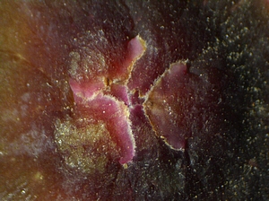 Reddened immature fig ostiolar scales (Silba adipata McAlpine oviposition).